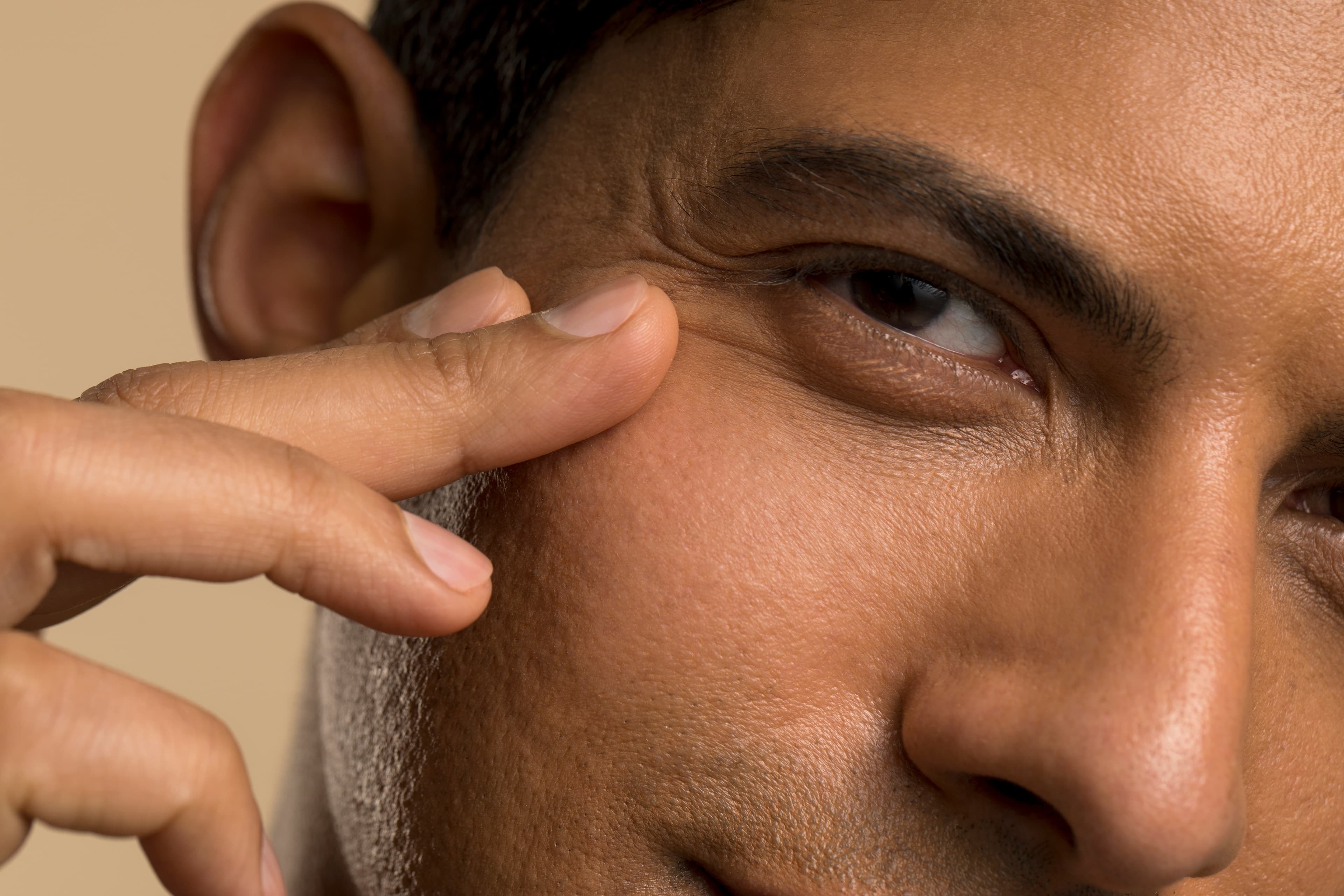 Cover image for: Tear Trough Filler in Malta: Erase Years of Under-Eye Tiredness