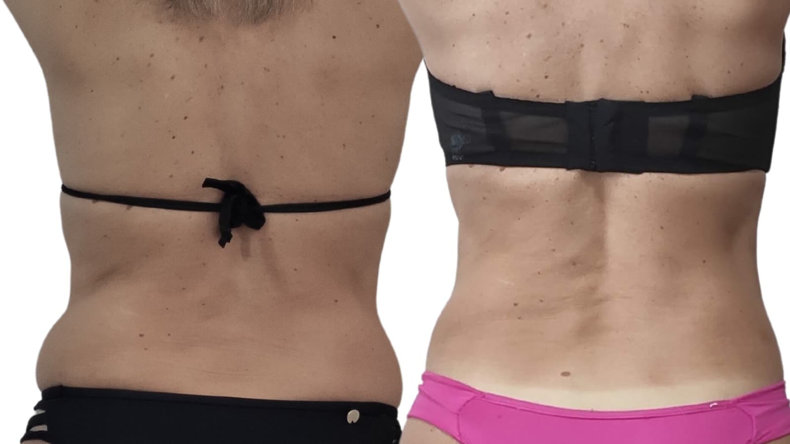 Cover image for: Non-Surgical: Achieve Your Summer Body Goals