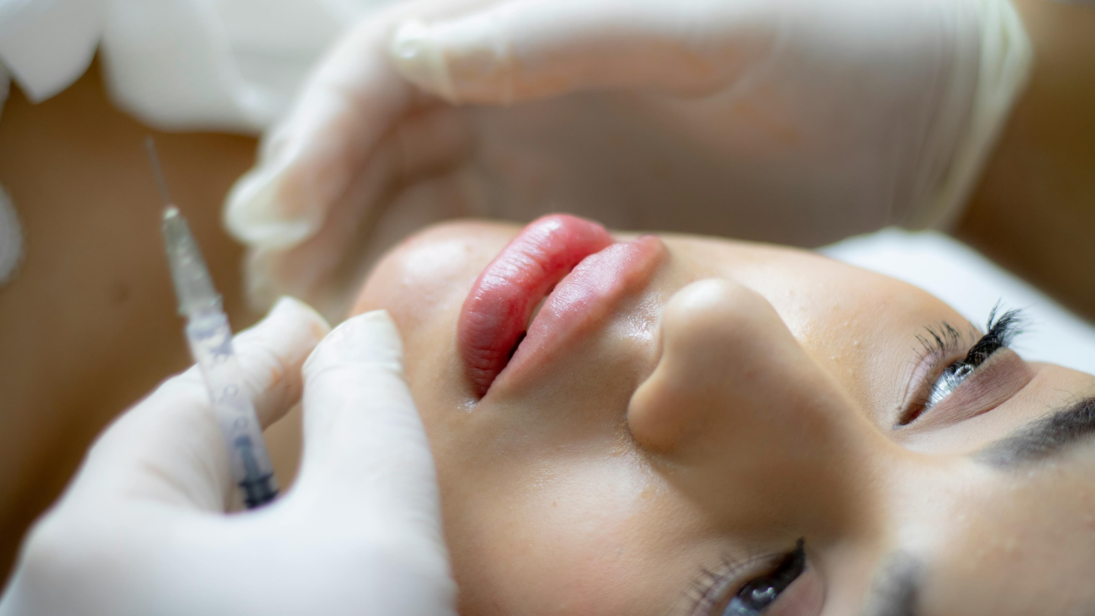 Cover image for: Russian Lips: Lifted. Defined. Effortlessly Elegant.