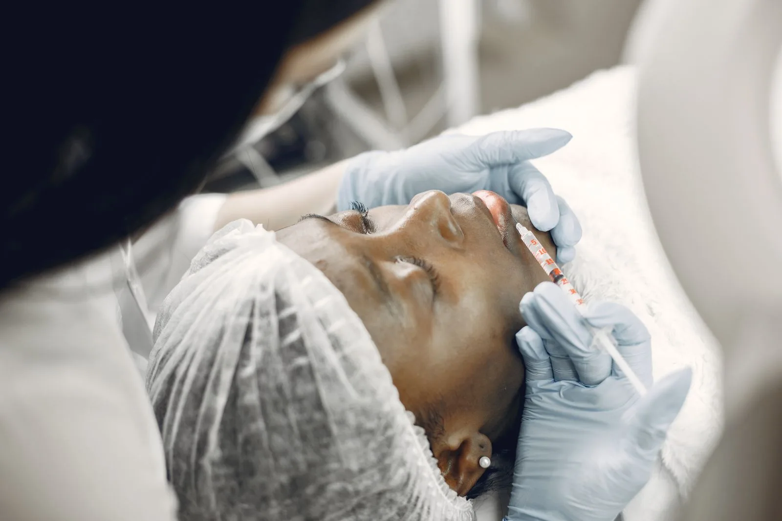 Close-up of a lip filler injection during dermal fillers treatment at a Malta aesthetic clinic