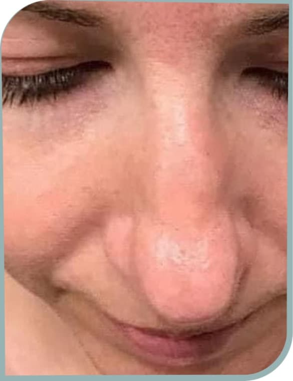 Refreshed central face, After photo (result 1 of 6)