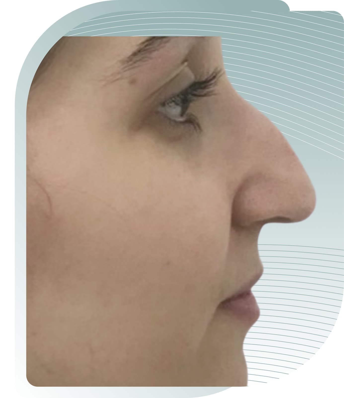 Profile Enhancement — Before photo (result 4 of 4)