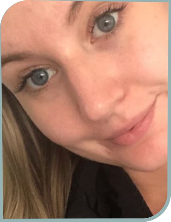 Forehead breakouts, After photo