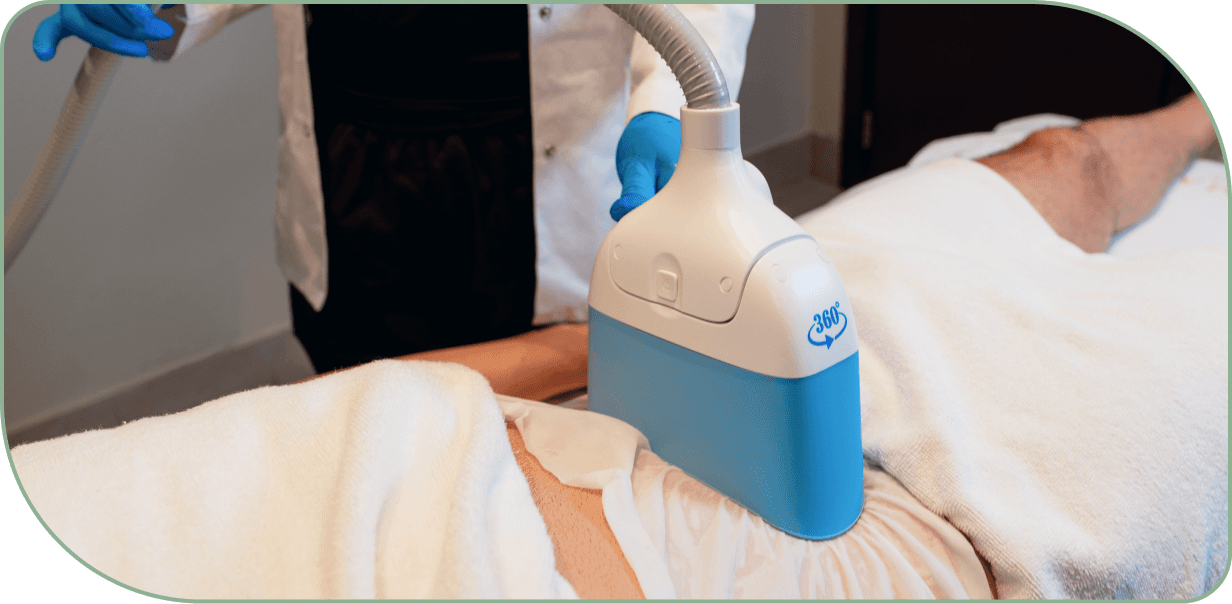 CoolSculpting