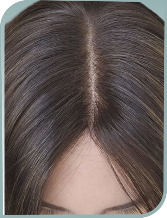 Thinning central parting, After photo (result 8 of 10)