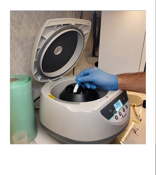 PRP Follicle Reactivation