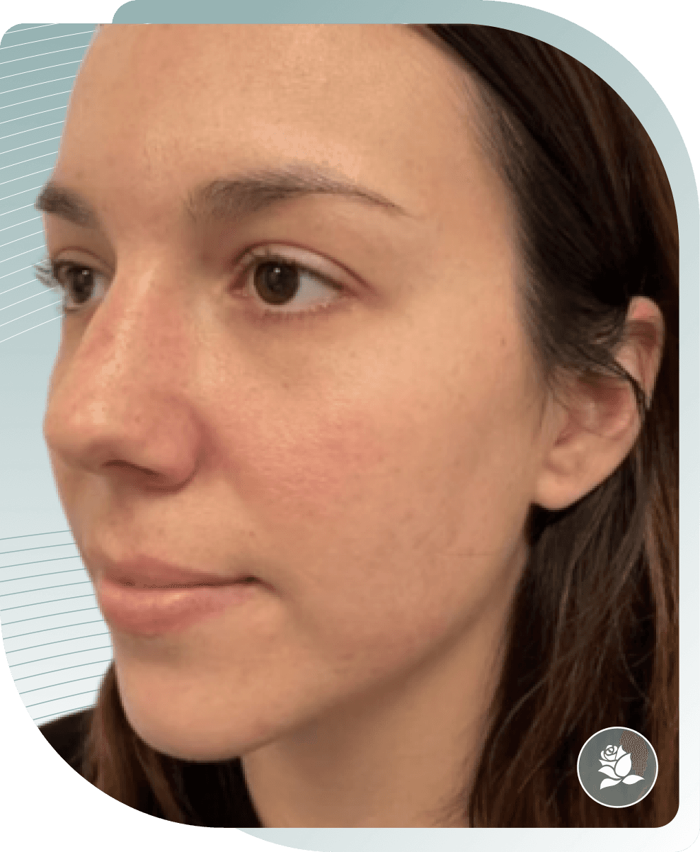 THE SECRET TO VISIBLY MORE BEAUTIFUL SKIN – OUR CUSTOMERS SHOW YOU HOW. — After photo (result 1 of 4)