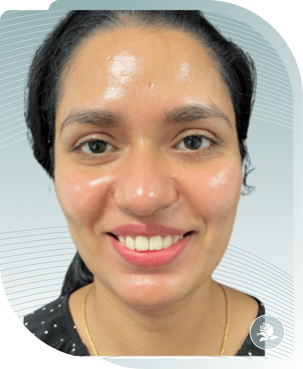 THE SECRET TO VISIBLY MORE BEAUTIFUL SKIN – OUR CUSTOMERS SHOW YOU HOW. — After photo (result 2 of 4)