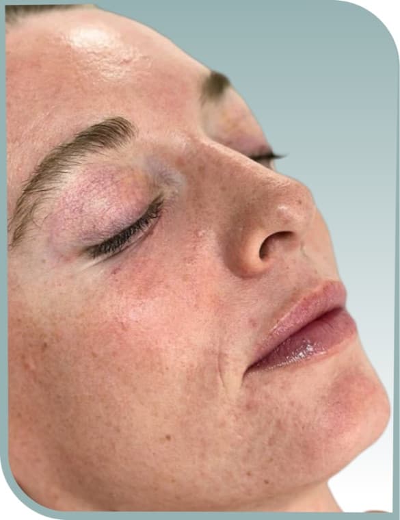 Hydration and radiance, Before photo (result 7 of 10)