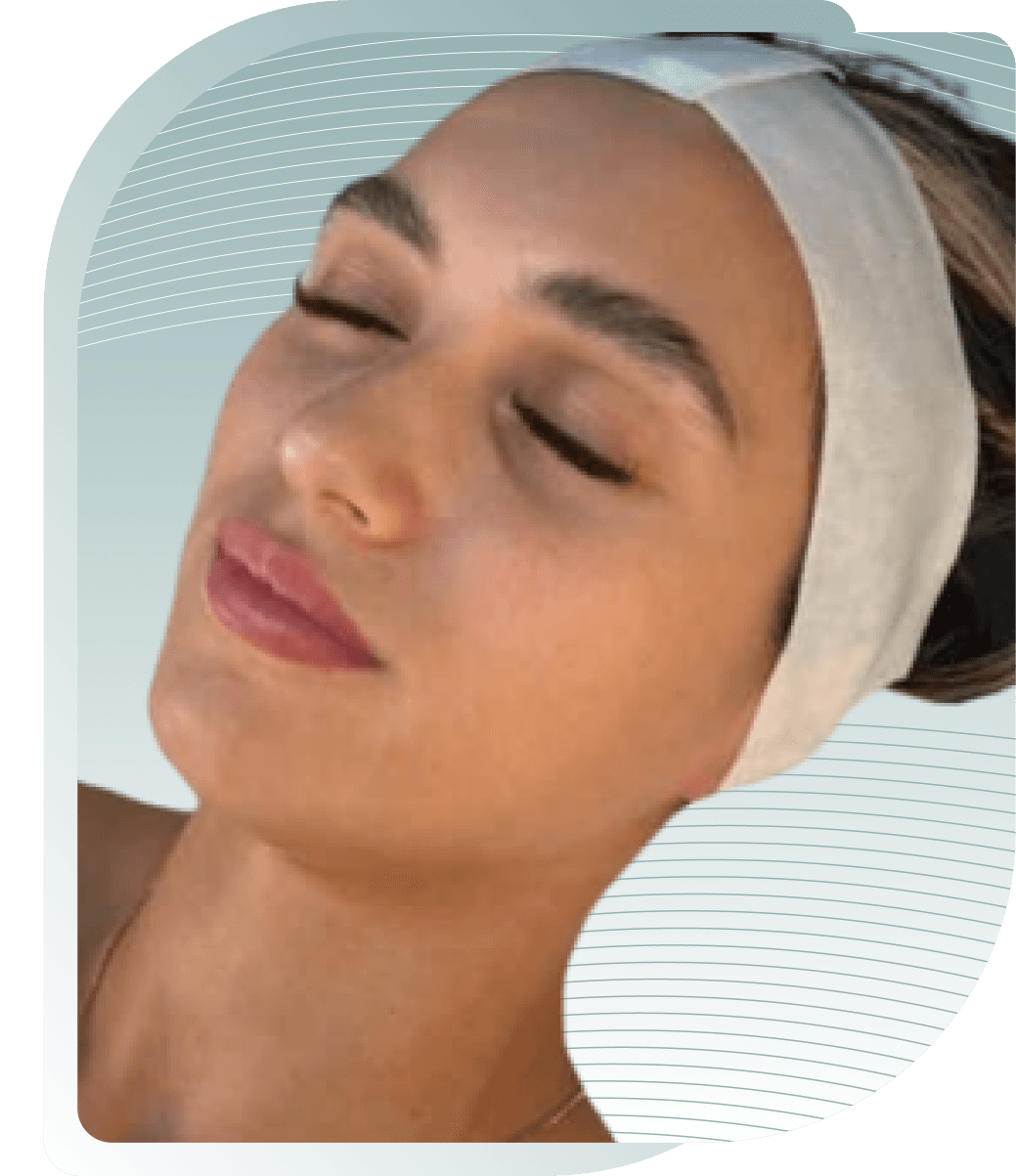THE SECRET TO VISIBLY MORE BEAUTIFUL SKIN – OUR CUSTOMERS SHOW YOU HOW. — Before photo (result 3 of 4)