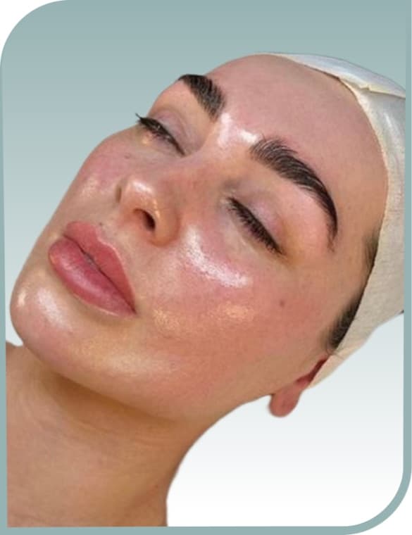 Fresh, dewy finish, After photo (result 9 of 10)