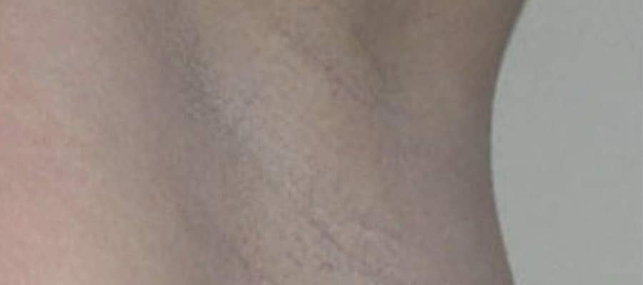 Ongoing Review & Lasting Results