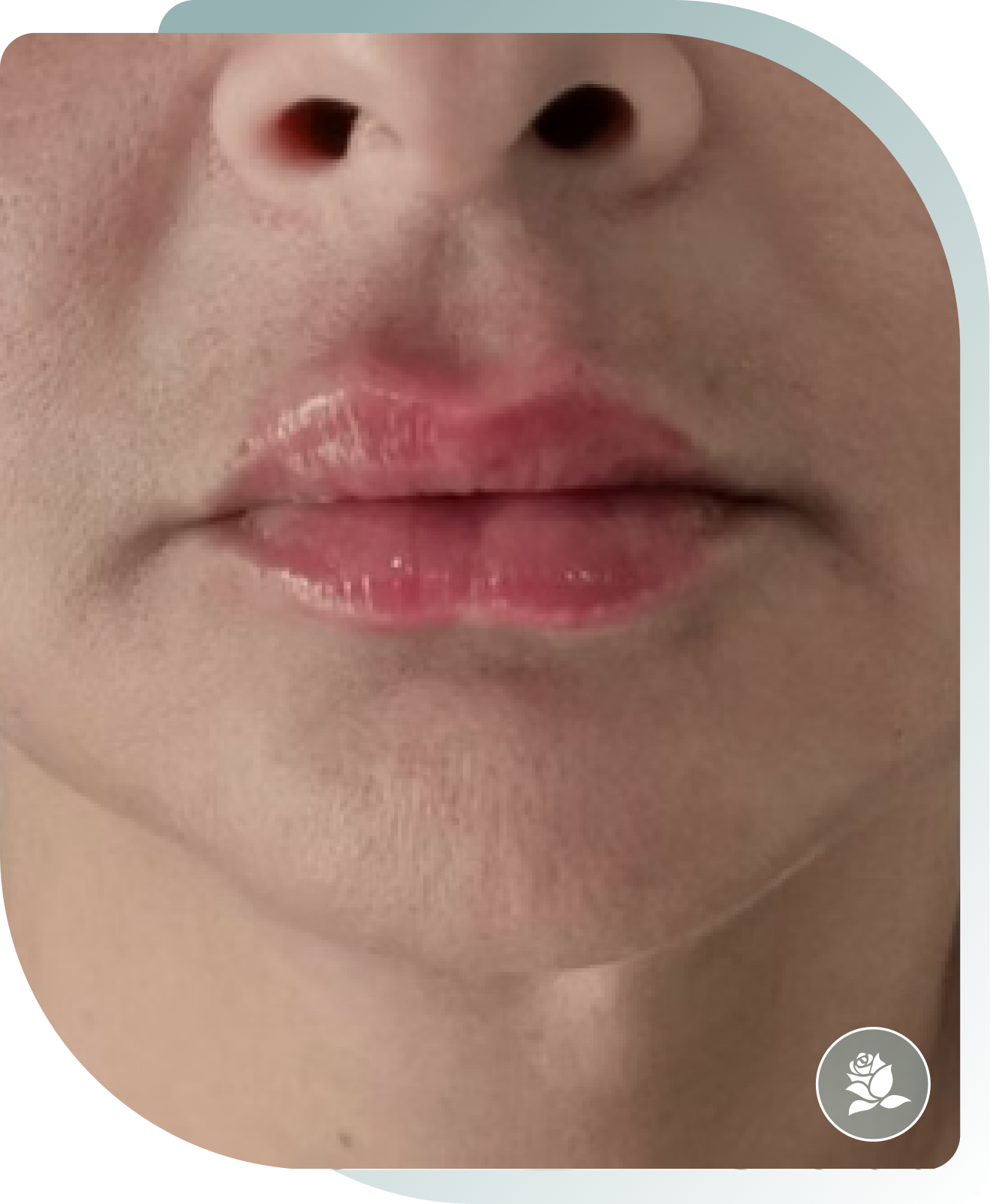 Natural Enhancement — After photo (result 1 of 5)