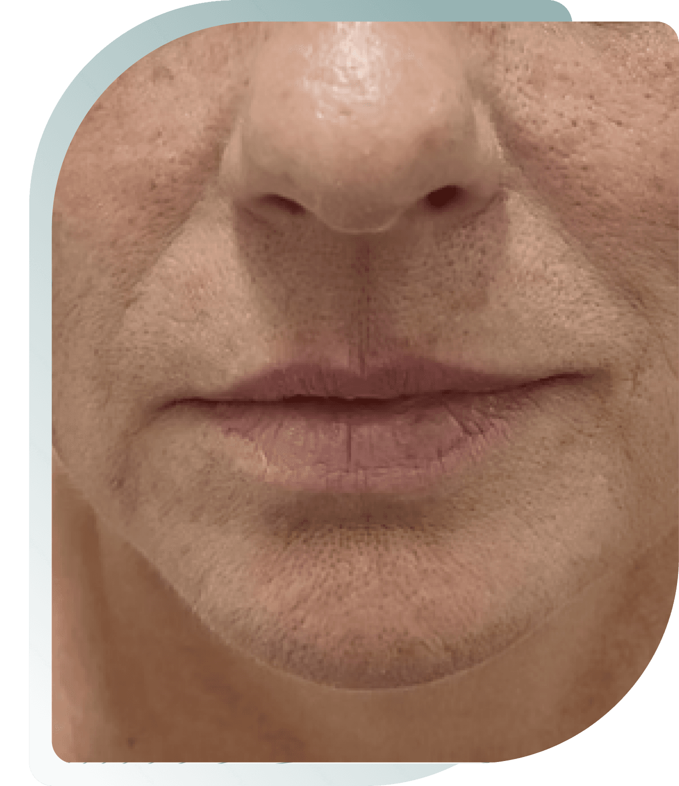 Hydration & Definition — Before photo (result 2 of 5)