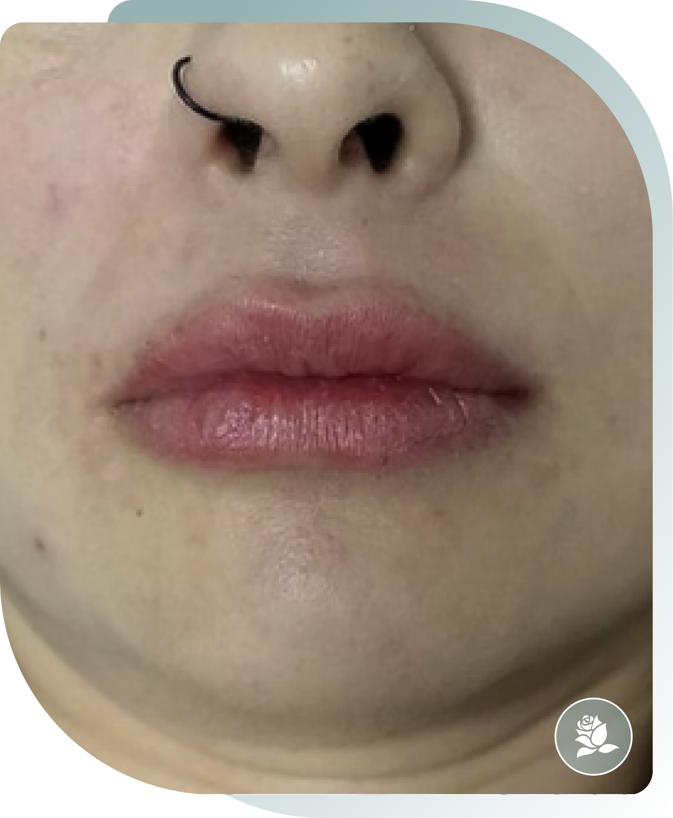 Shape & Symmetry — After photo (result 3 of 5)