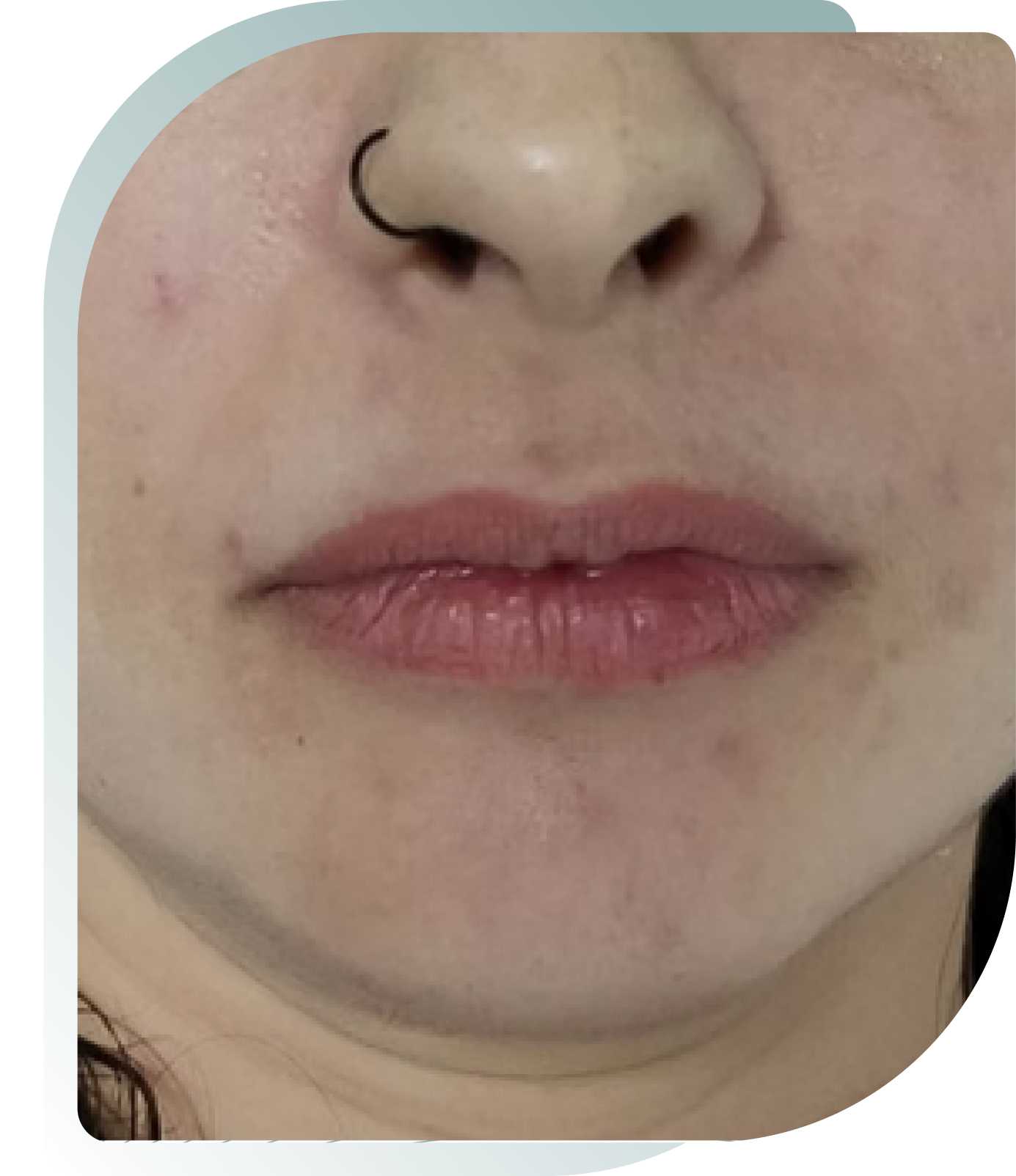 Shape & Symmetry — Before photo (result 3 of 5)