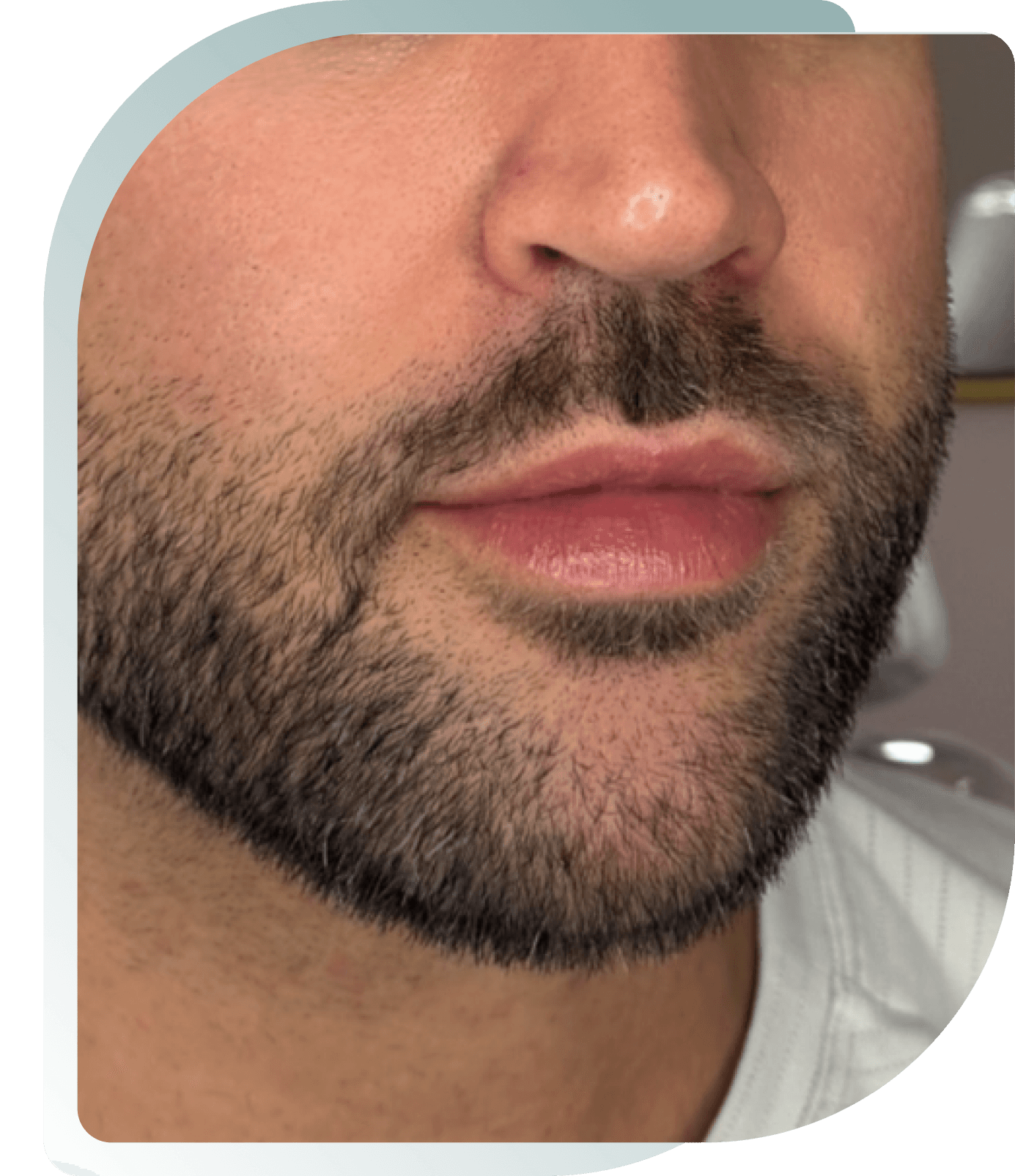 Subtle Enhancement — Before photo (result 5 of 5)