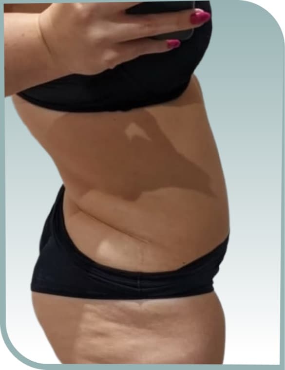 Waistline definition, Before photo (result 6 of 10)