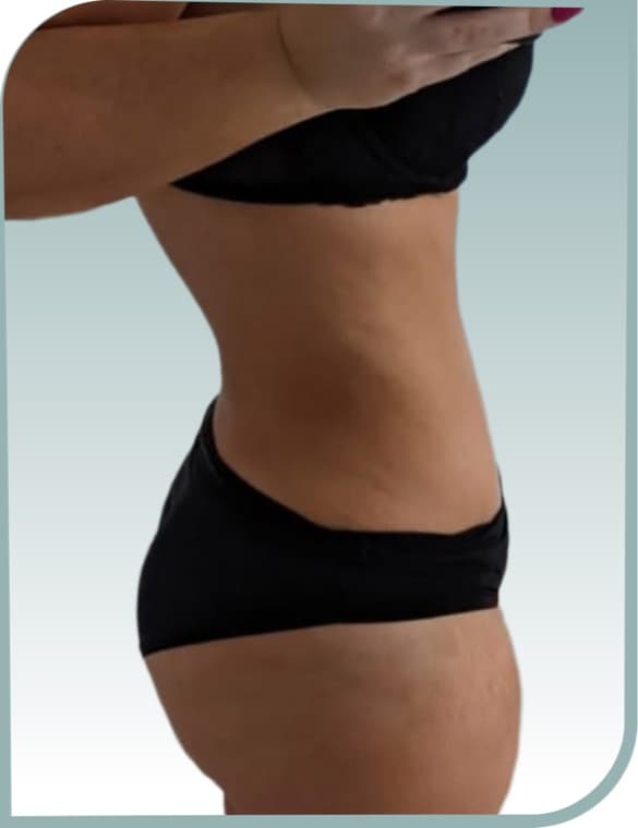 Waistline definition, After photo (result 6 of 10)