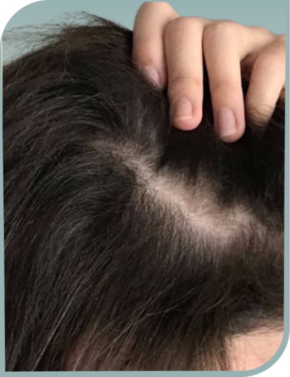 Thinning crown, After photo (result 1 of 10)