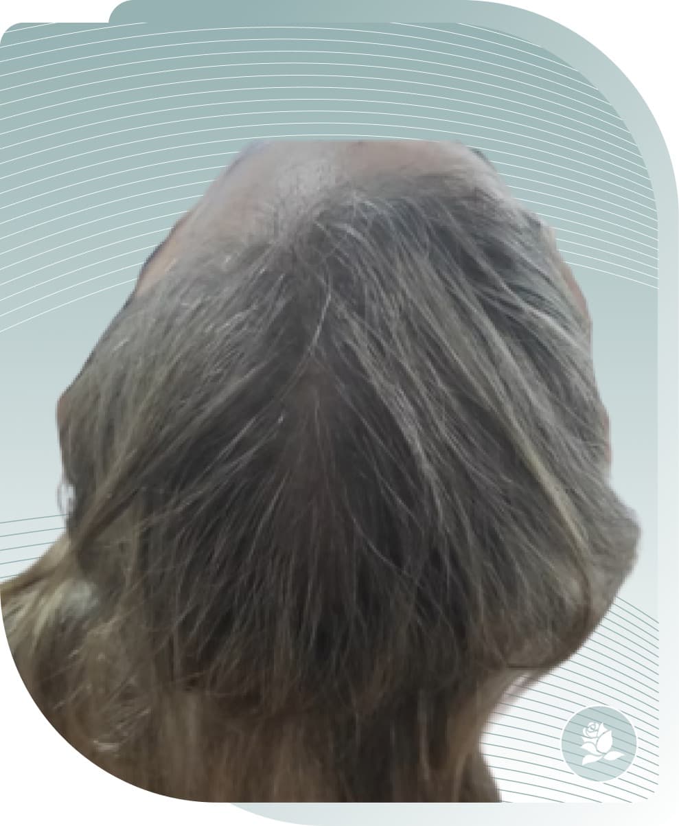 Scalp & Hair — After photo (result 1 of 5)