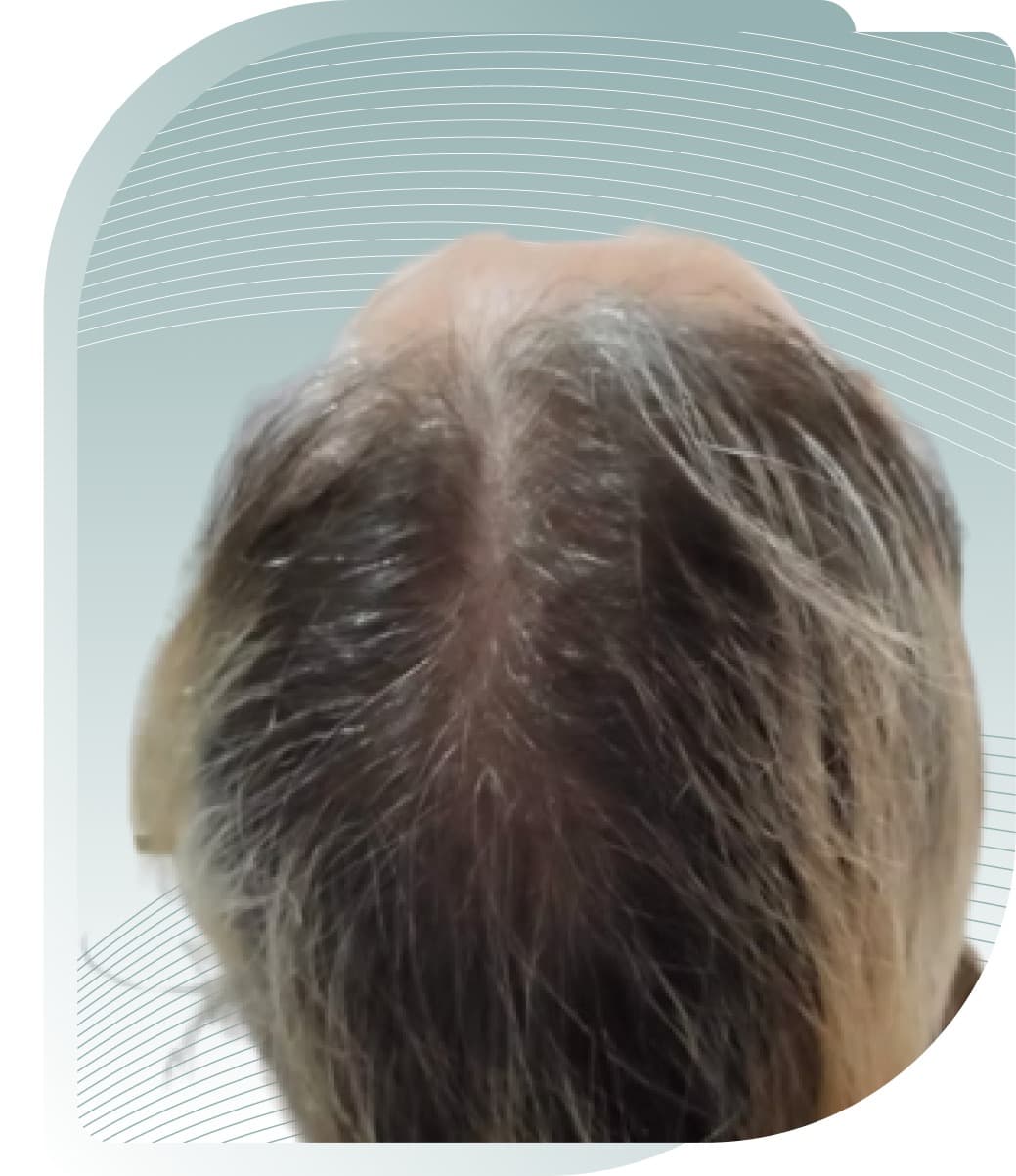 Scalp & Hair — Before photo (result 1 of 5)