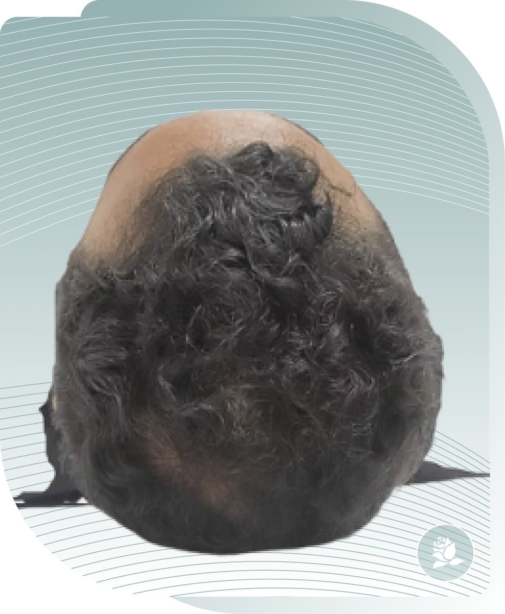 Scalp & Hair — After photo (result 2 of 5)