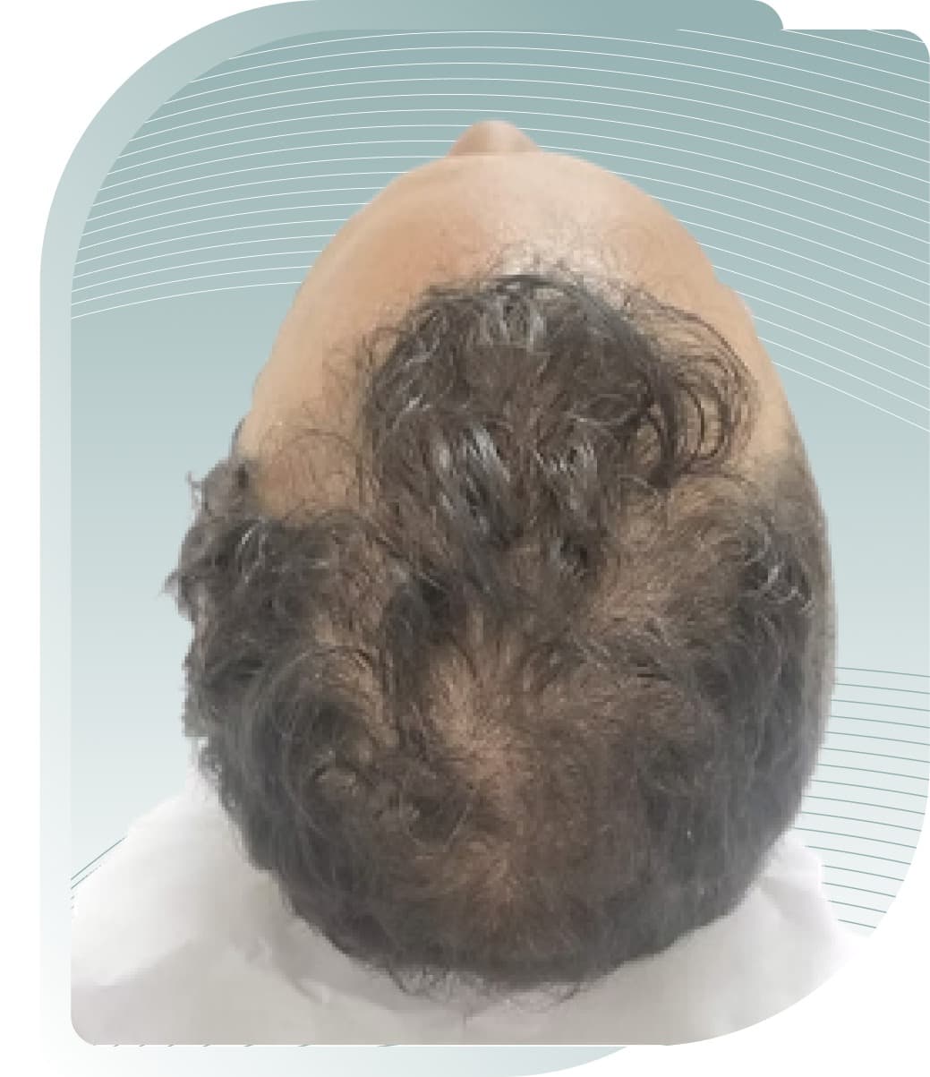 Scalp & Hair — Before photo (result 2 of 5)