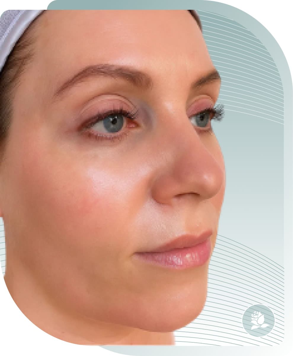 Radiance & Tone — After photo (result 4 of 5)
