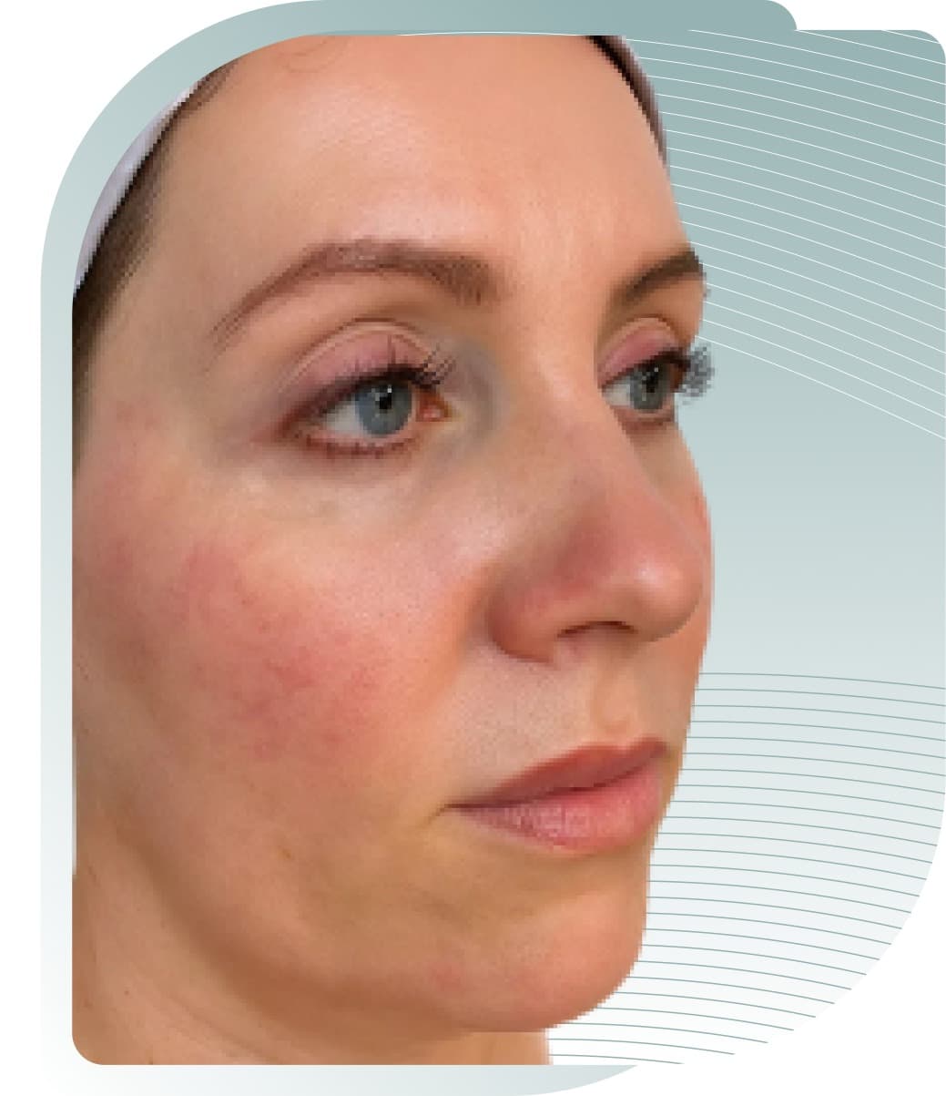 Radiance & Tone — Before photo (result 4 of 5)