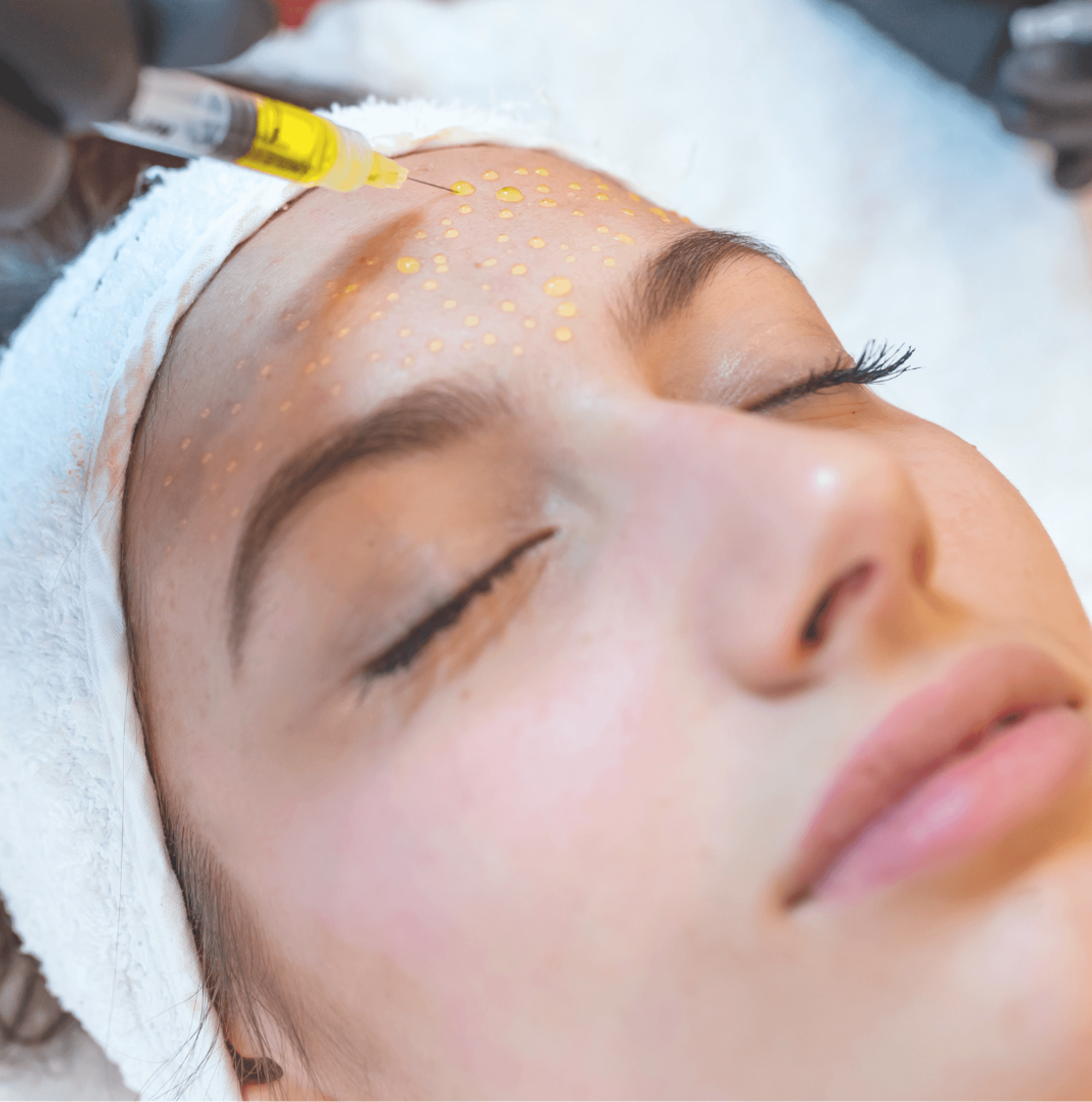 Mesotherapy Malta | Skin Boosters — Carisma Aesthetics Malta