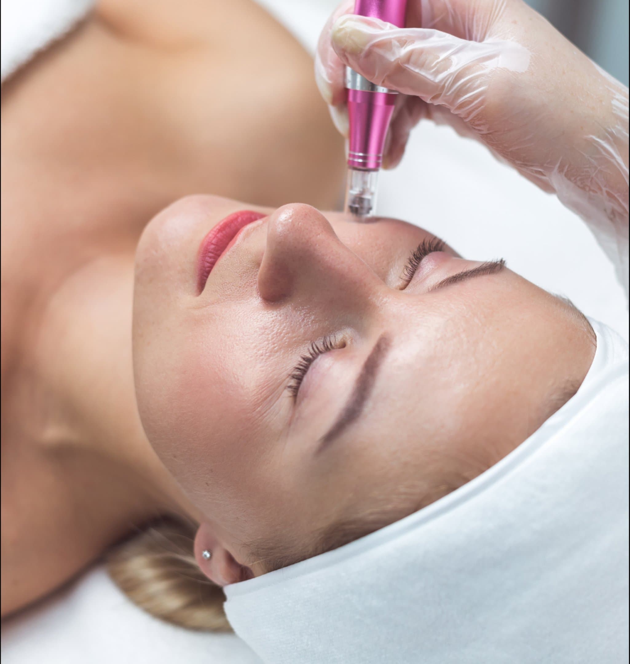 Exosome Glow Lift in Malta, Carisma Aesthetics Malta