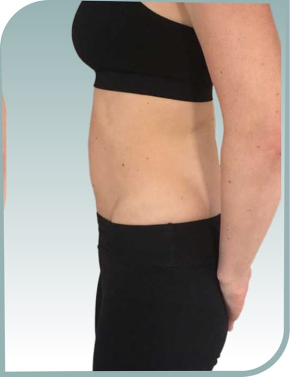 Core toning, After photo (result 6 of 10)