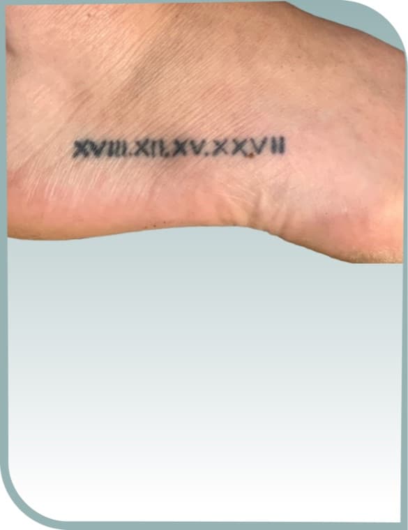 Foot numerals fading, Before photo (result 1 of 10)