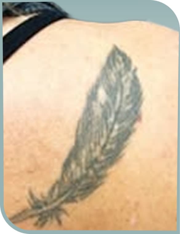 Back feather fading, Before photo (result 4 of 10)