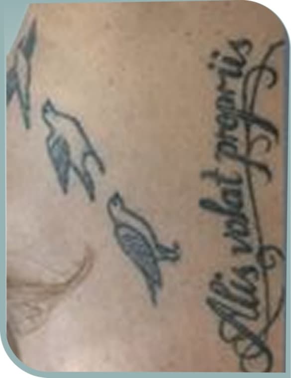 Leg script fading, Before photo (result 9 of 10)