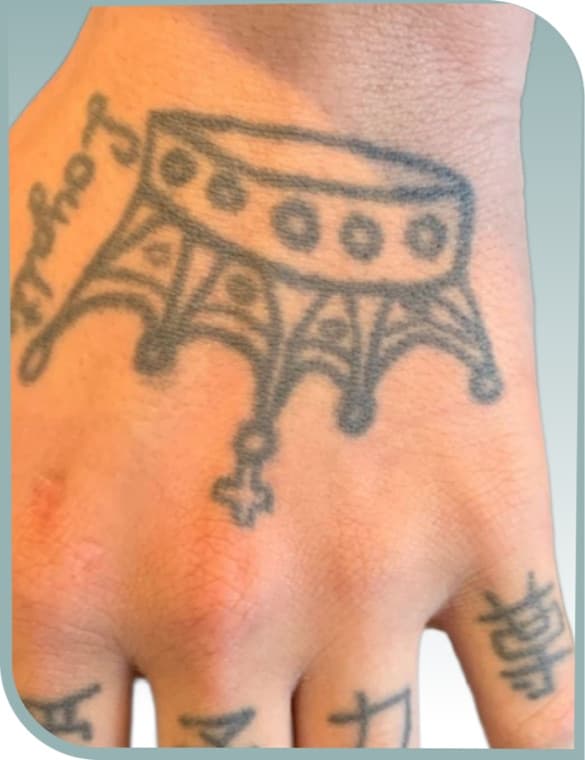 Hand tattoo fading, Before photo (result 10 of 10)