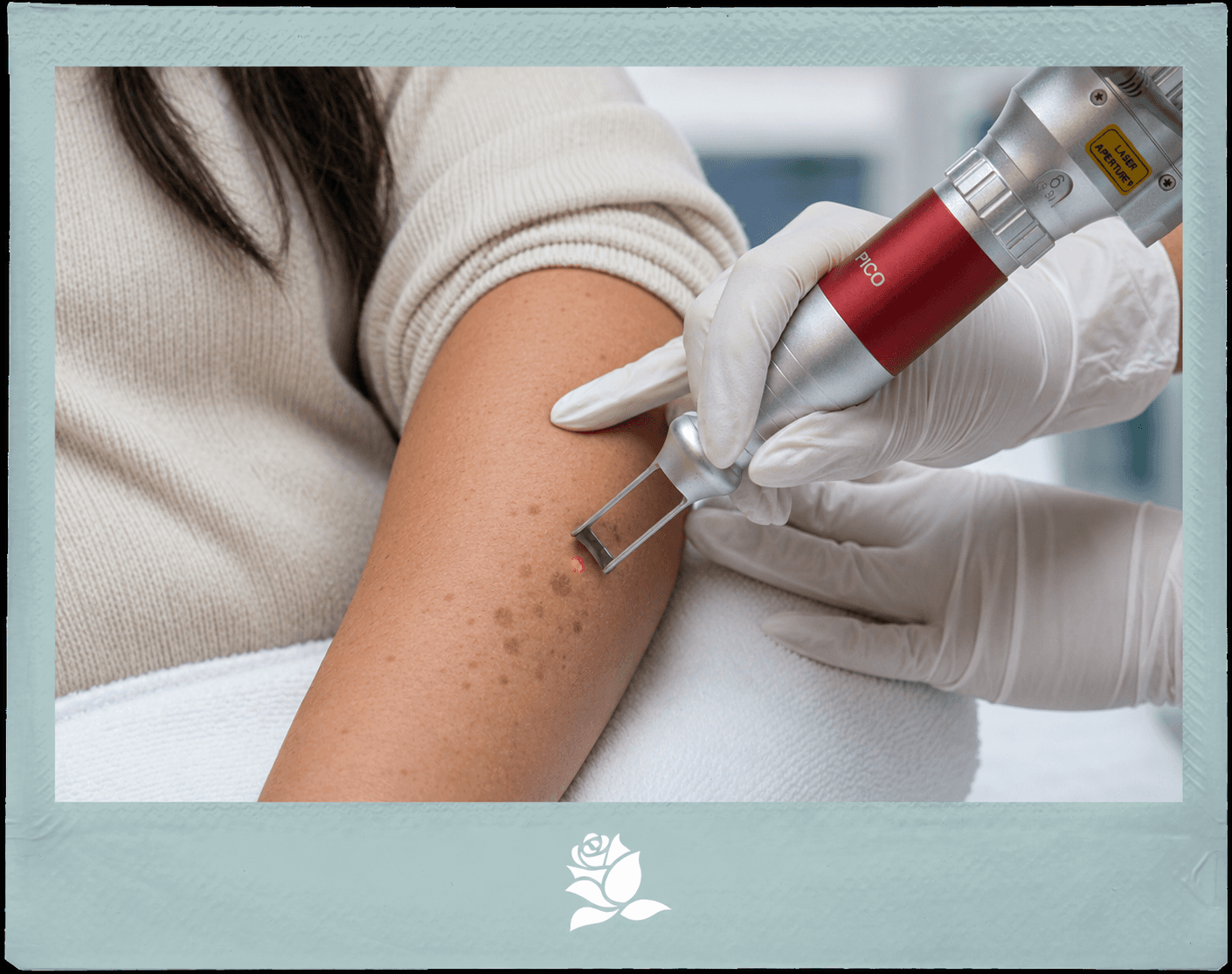 Laser Pigmentation Removal Treatment in Malta, Carisma Aesthetics Malta