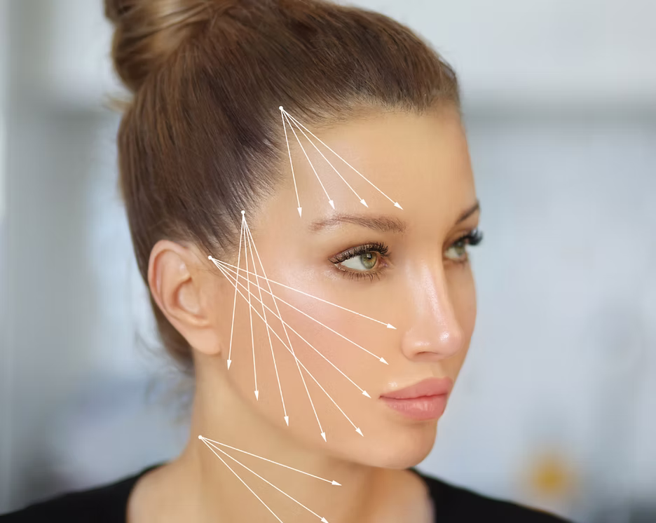 Thread lift treatment at Carisma Aesthetics Malta
